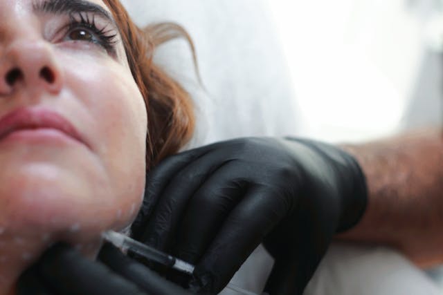 Before And After Dermal Fillers: What You Should Know